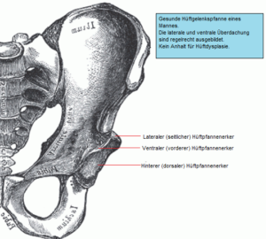 Arthrose Hüfte gesund